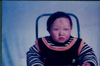 ���ݷ���Ƥ����ҽԺ