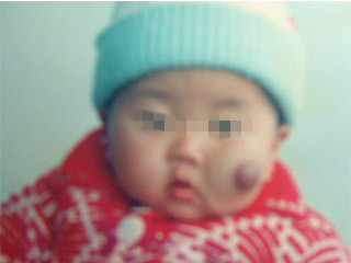 ���ݷ���Ƥ����ҽԺ