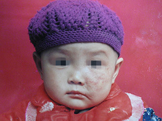 ���ݷ���Ƥ����ҽԺ