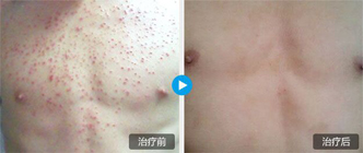 ���ݷ���Ƥ����ҽԺ