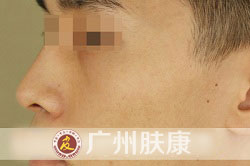 ���ݷ���Ƥ����ҽԺ