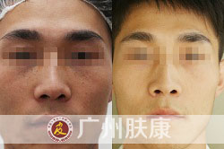 ���ݷ���Ƥ����ҽԺ