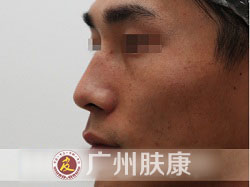 ���ݷ���Ƥ����ҽԺ