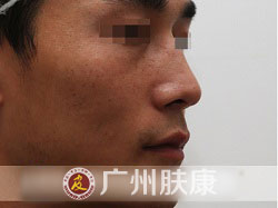 ���ݷ���Ƥ����ҽԺ