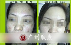 ���ݷ���Ƥ����ҽԺ