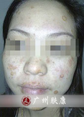 ���ݷ���Ƥ����ҽԺ