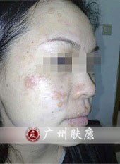 ���ݷ���Ƥ����ҽԺ