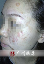 ���ݷ���Ƥ����ҽԺ