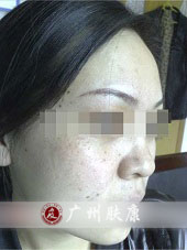 ���ݷ���Ƥ����ҽԺ