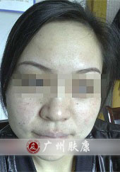 ���ݷ���Ƥ����ҽԺ