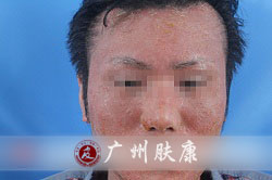 ���ݷ���Ƥ����ҽԺ