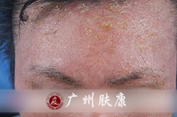 ���ݷ���Ƥ����ҽԺ