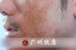 ���ݷ���Ƥ����ҽԺ