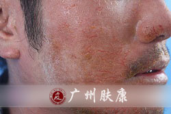 ���ݷ���Ƥ����ҽԺ