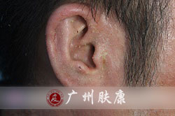 ���ݷ���Ƥ����ҽԺ