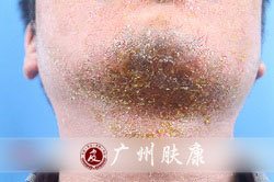 ���ݷ���Ƥ����ҽԺ