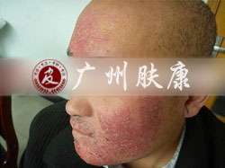 ���ݷ���Ƥ����ҽԺ