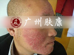 ���ݷ���Ƥ����ҽԺ