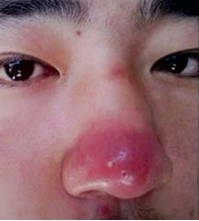 广州肤康皮肤病医院