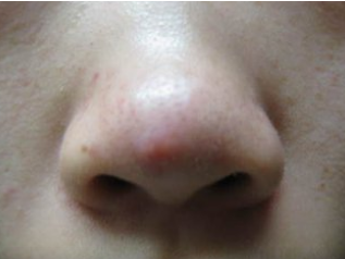 广州肤康皮肤病医院