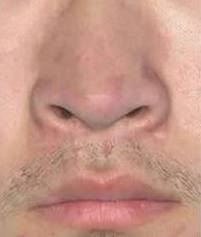 广州肤康皮肤病医院