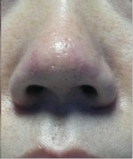 广州肤康皮肤病医院