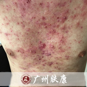 ���ݷ���Ƥ����ҽԺ