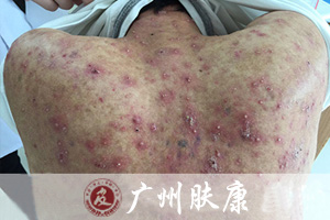 ���ݷ���Ƥ����ҽԺ