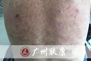 ���ݷ���Ƥ����ҽԺ