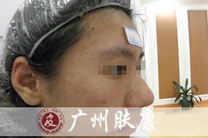 ���ݷ���Ƥ����ҽԺ