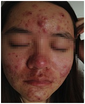 ���ݷ���Ƥ����ҽԺ