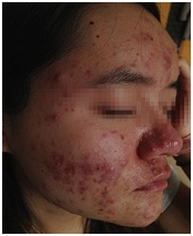 ���ݷ���Ƥ����ҽԺ