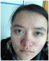 ���ݷ���Ƥ����ҽԺ