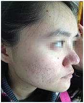 ���ݷ���Ƥ����ҽԺ