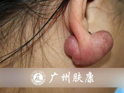 ���ݷ���Ƥ����ҽԺ