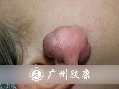 ���ݷ���Ƥ����ҽԺ