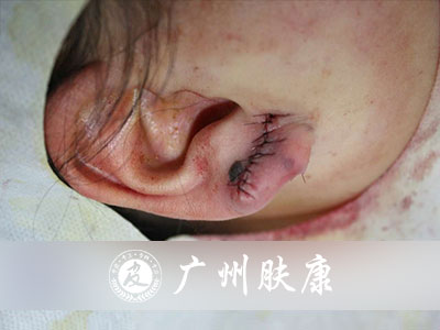 ���ݷ���Ƥ����ҽԺ