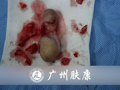 ���ݷ���Ƥ����ҽԺ