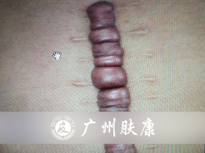 ���ݷ���Ƥ����ҽԺ