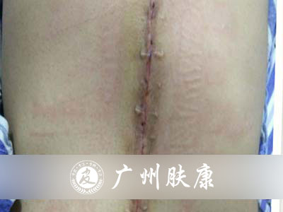 ���ݷ���Ƥ����ҽԺ