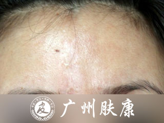 ���ݷ���Ƥ����ҽԺ