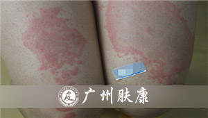 ���ݷ���Ƥ����ҽԺ