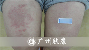 ���ݷ���Ƥ����ҽԺ