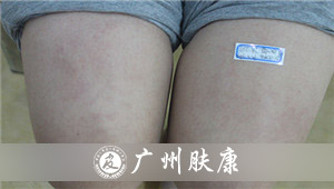 ���ݷ���Ƥ����ҽԺ