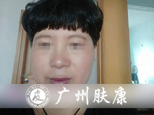 ���ݷ���Ƥ����ҽԺ