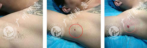 ���ݷ���Ƥ����ҽԺ