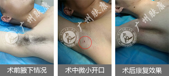 ���ݷ���Ƥ����ҽԺ