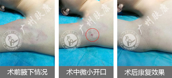 ���ݷ���Ƥ����ҽԺ