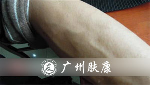 ���ݷ���Ƥ����ҽԺ