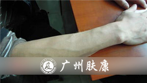 ���ݷ���Ƥ����ҽԺ